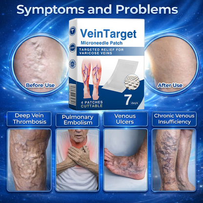 Stop Wasting Money on Useless Varicose Vein Creams That Can't Penetrate Where It Matters-8CR5