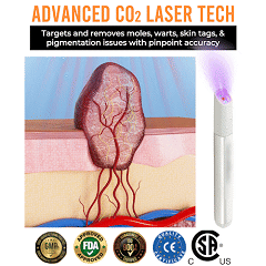 ✨ LIMITED TIME 50% OFF 💖All-in-One CO₂ Laser Eraser Pen | Removes Moles, Warts, Skin Flaws & Pigmentation-8YF7