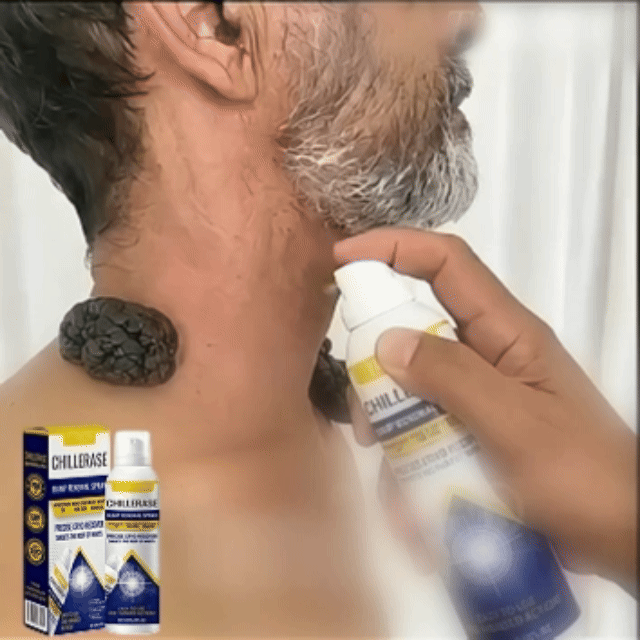 🏆 #1 Dermatologist-Recommended Cryo Renewal Spray🥼| Removes warts and skin tags efficiently while promoting your skin’s natural recovery🧪-8HJ9