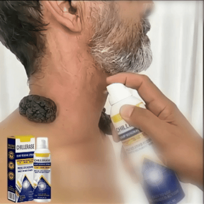 🏆 #1 Dermatologist-Recommended Cryo Renewal Spray🥼| Removes warts and skin tags efficiently while promoting your skin’s natural recovery🧪-8HJ9